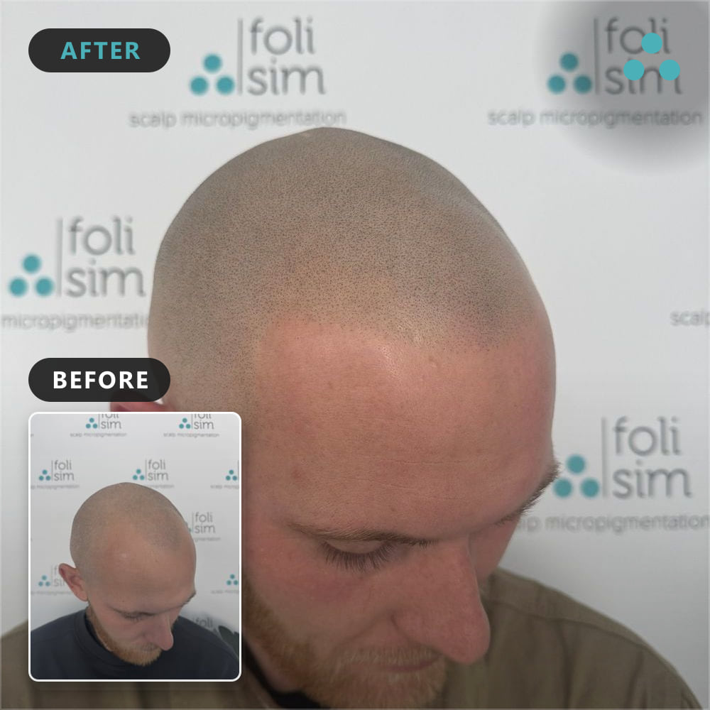 25 robbie williamson ok to show face, Foli Sim