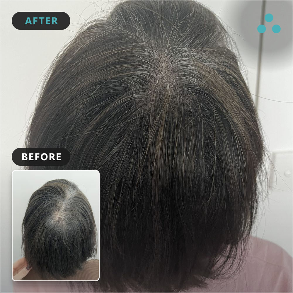 37 di wei luo conceal identity, Foli Sim