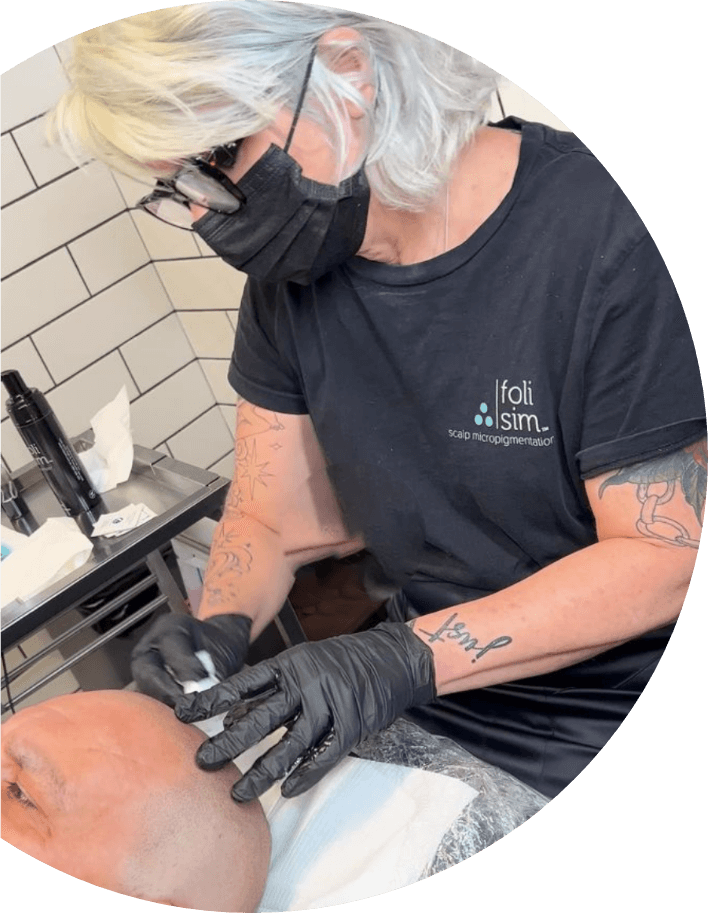 Scalp Micropigmentation Sydney