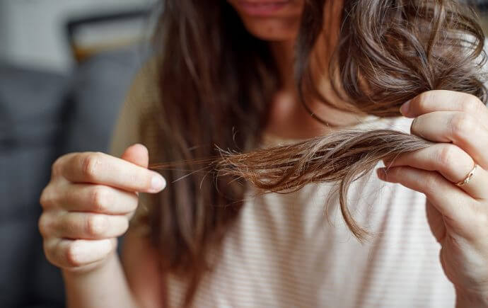 Does Stress Cause Hair Loss