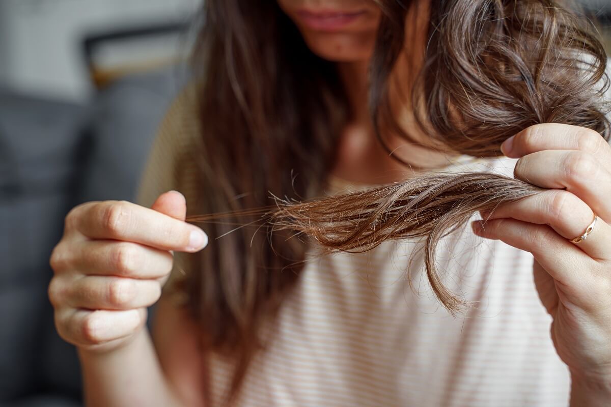 Does Stress Cause Hair Loss