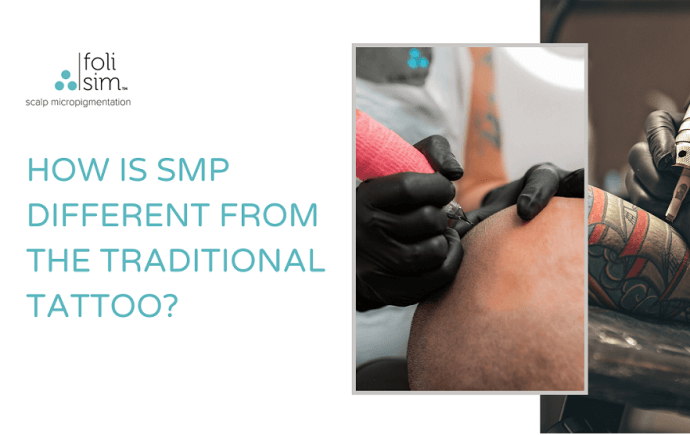 scalp micropigmentation vs tattoo