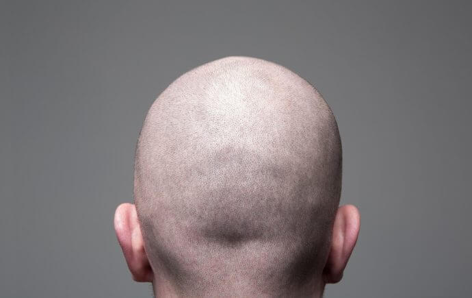 shave your head for scalp micropigmentation