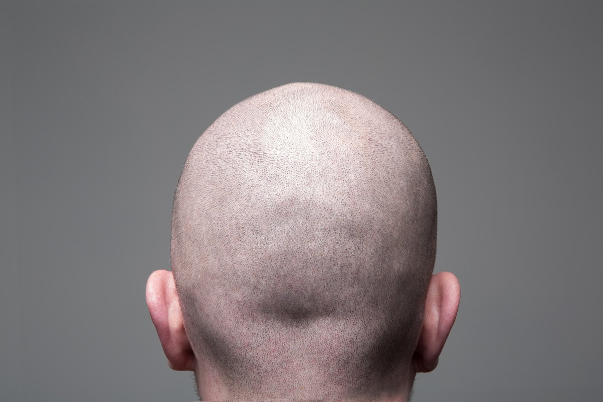 shave your head for scalp micropigmentation