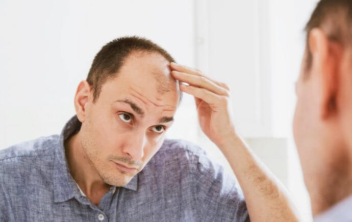 male pattern baldness