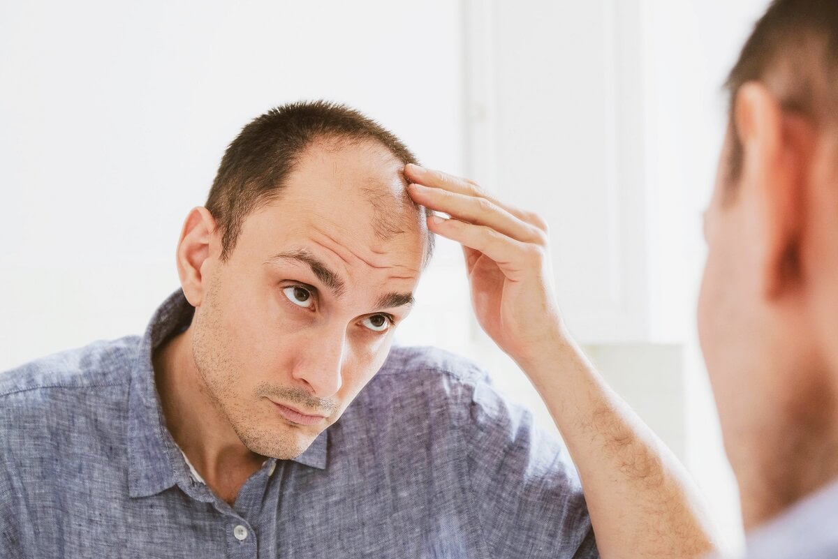 male pattern baldness