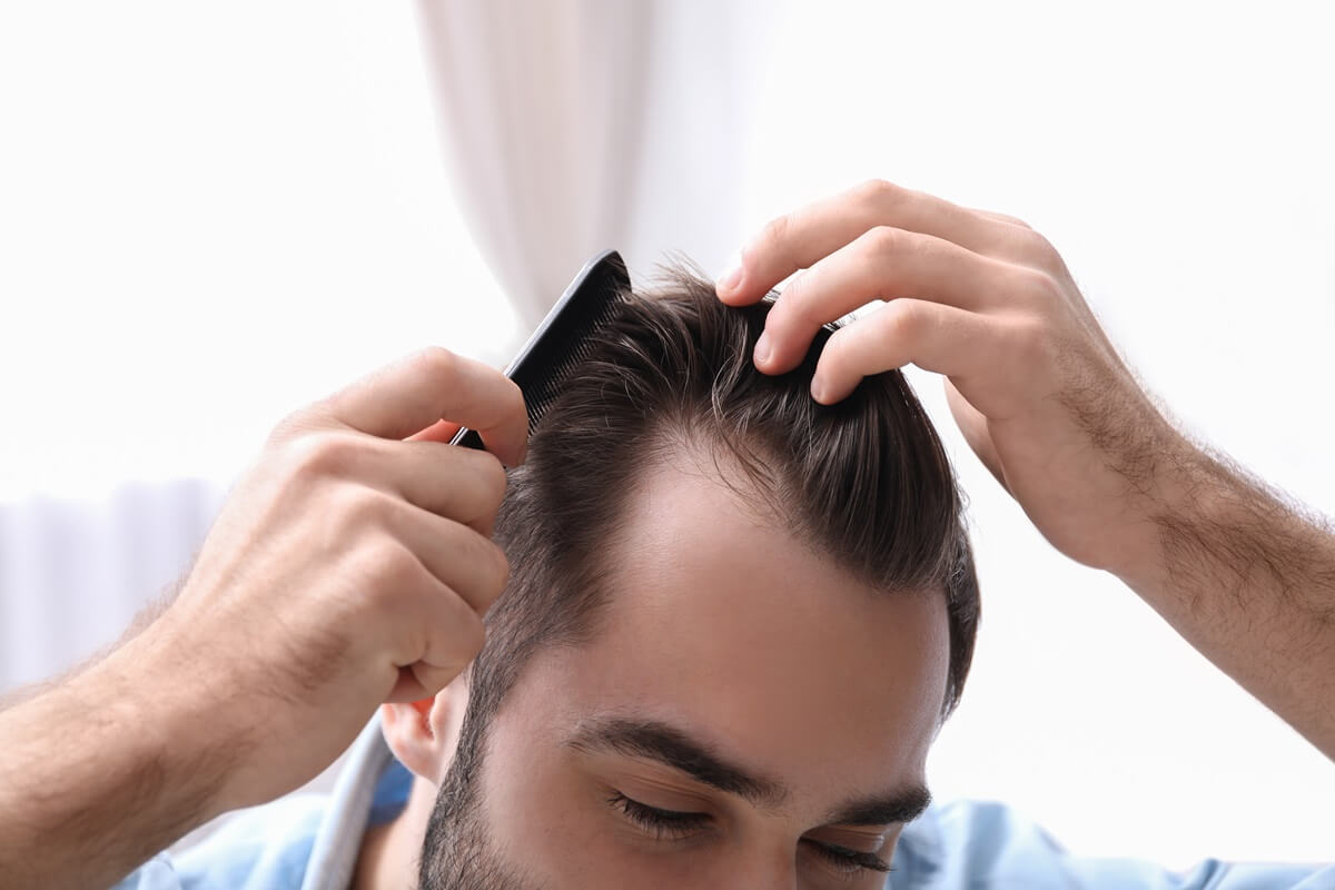 the impacts of nicotine on hair loss