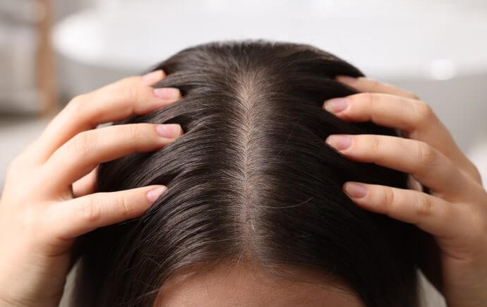 How to Improve Scalp Health