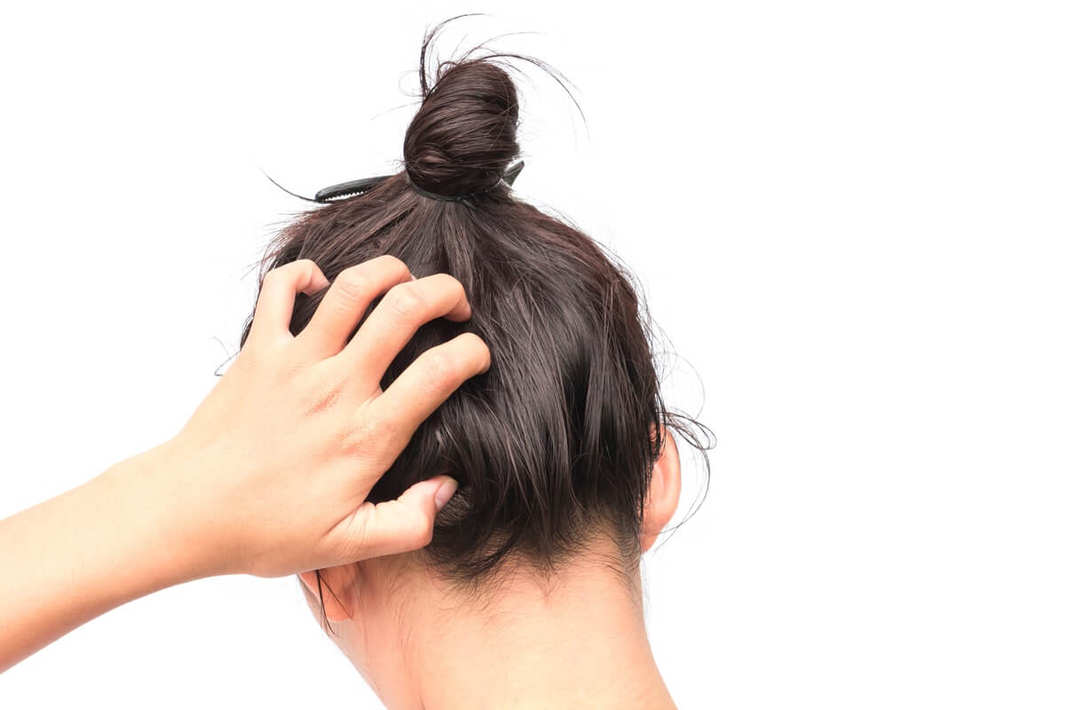 Dandruff and hair loss